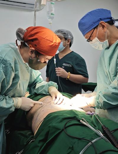 Operative photograph of the surgical team working over surgical markings on a draped abdomen. The patient's face is not shown.